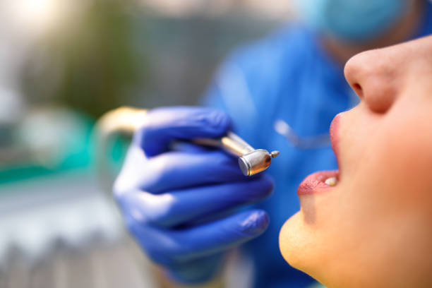 Best Veneers and Lumineers  in Tara Hills, CA